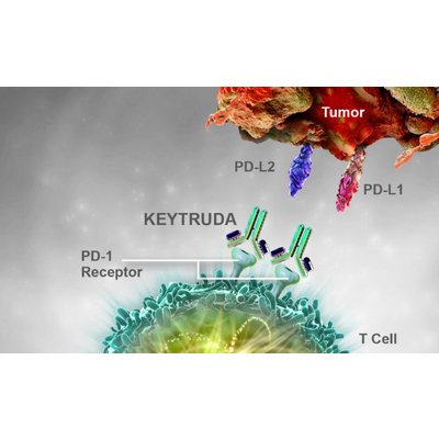 Keytruda ефективний при раку шийки матки